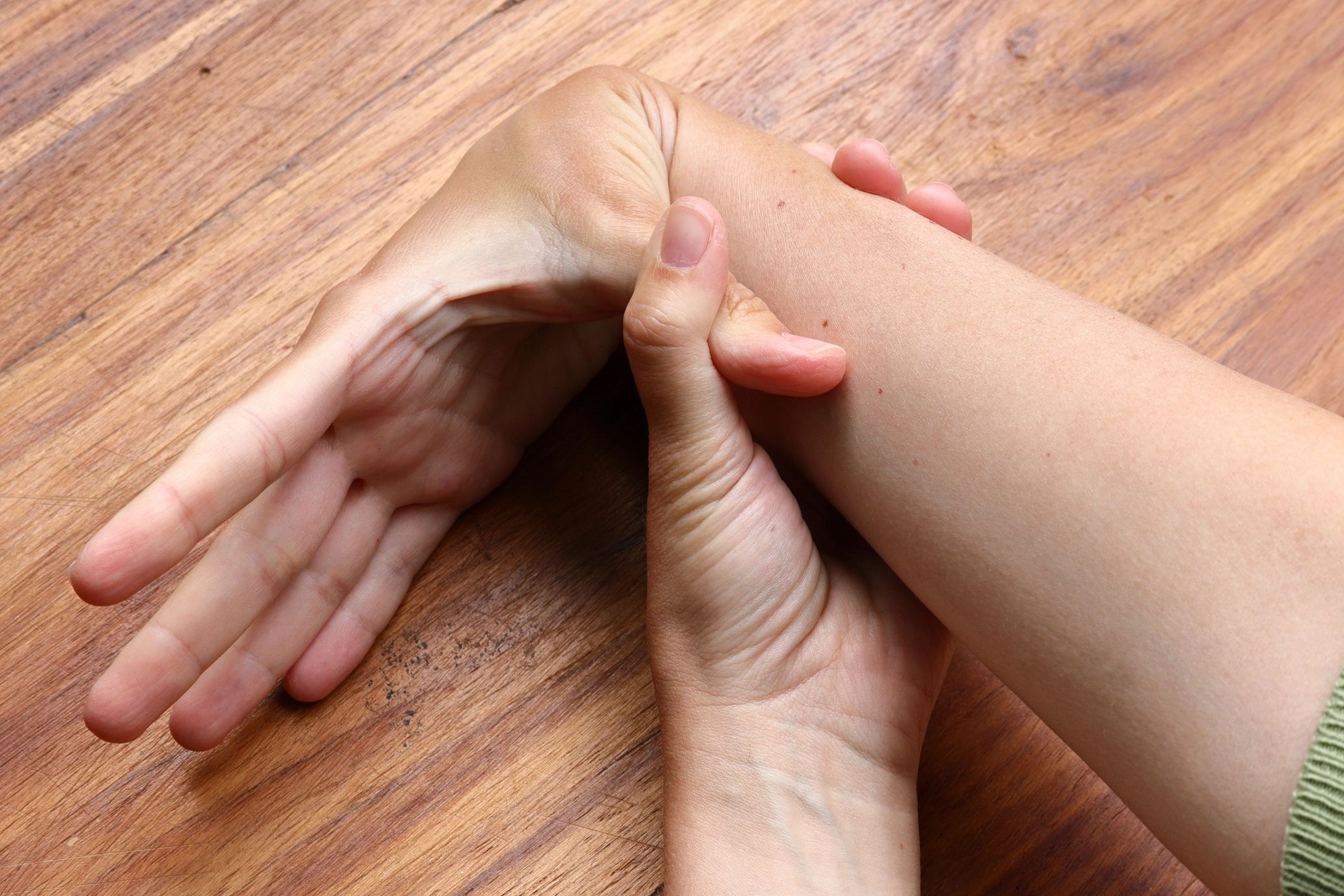 A patient with hypermobile Ehlers-Danlos Syndrome bends their thumb down to their wrist.