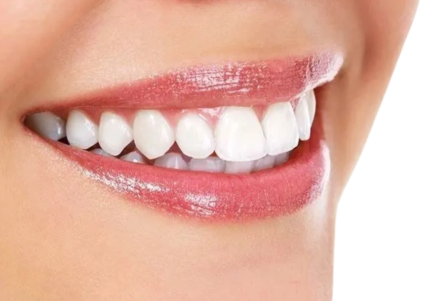 Pretty smile, straight teeth