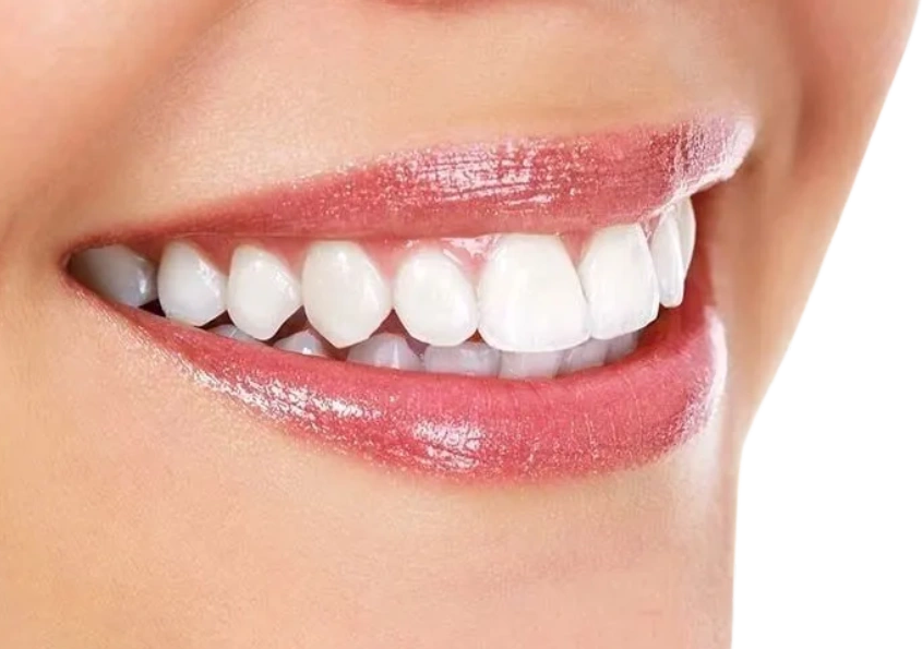 Pretty smile, straight teeth