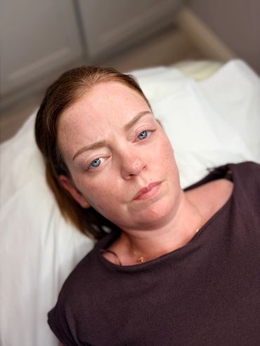 Healed brows 