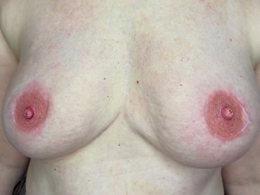 Close-up of bare female chest.