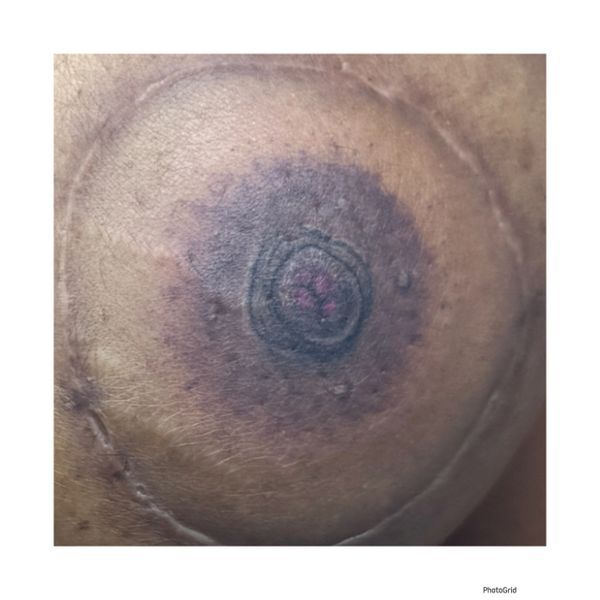 3d areola tattooing