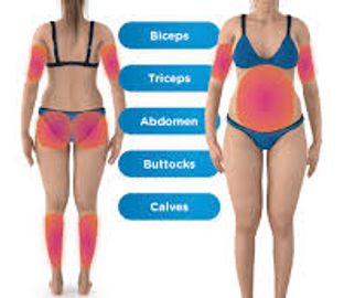 Body Toning & RF Tightening "Body by Dr. Jennifer" (Exercise Optional)
