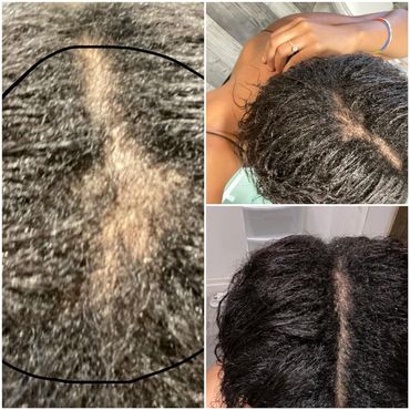 3 weeks progress using Hair Growth Oil and Mango Butter Treat