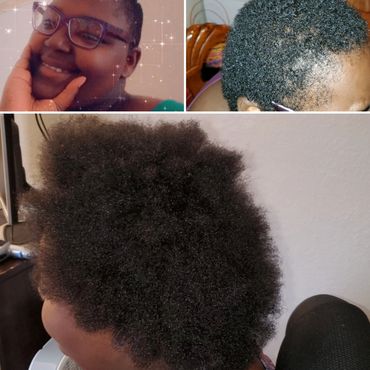 6 month progress using all products