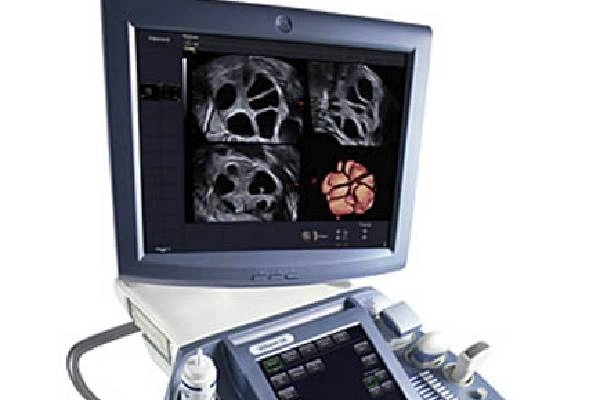 Computer screen shows detailed ultrasound scan of the brain for medical analysis.