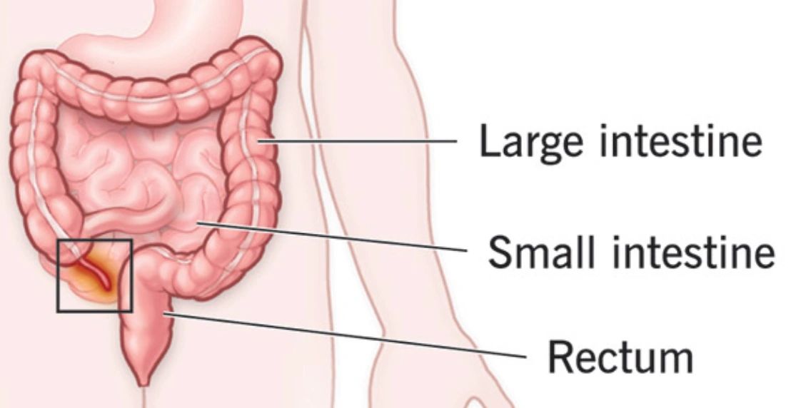 Why do We Have an Appendix?