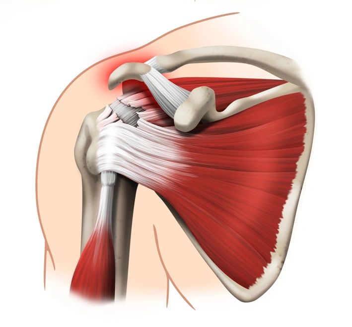 Rotator Cuff мышца