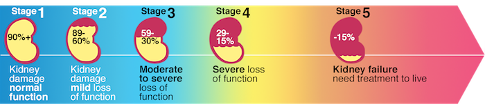 In this image the representative % describes the remaining kidney function with each stage of CKD.