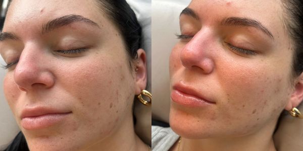 Before & after ✨