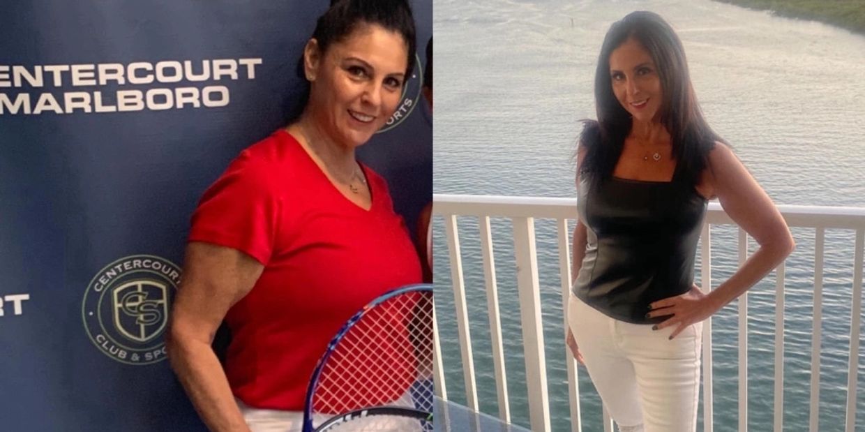 Sherri Lane Before and After Photos