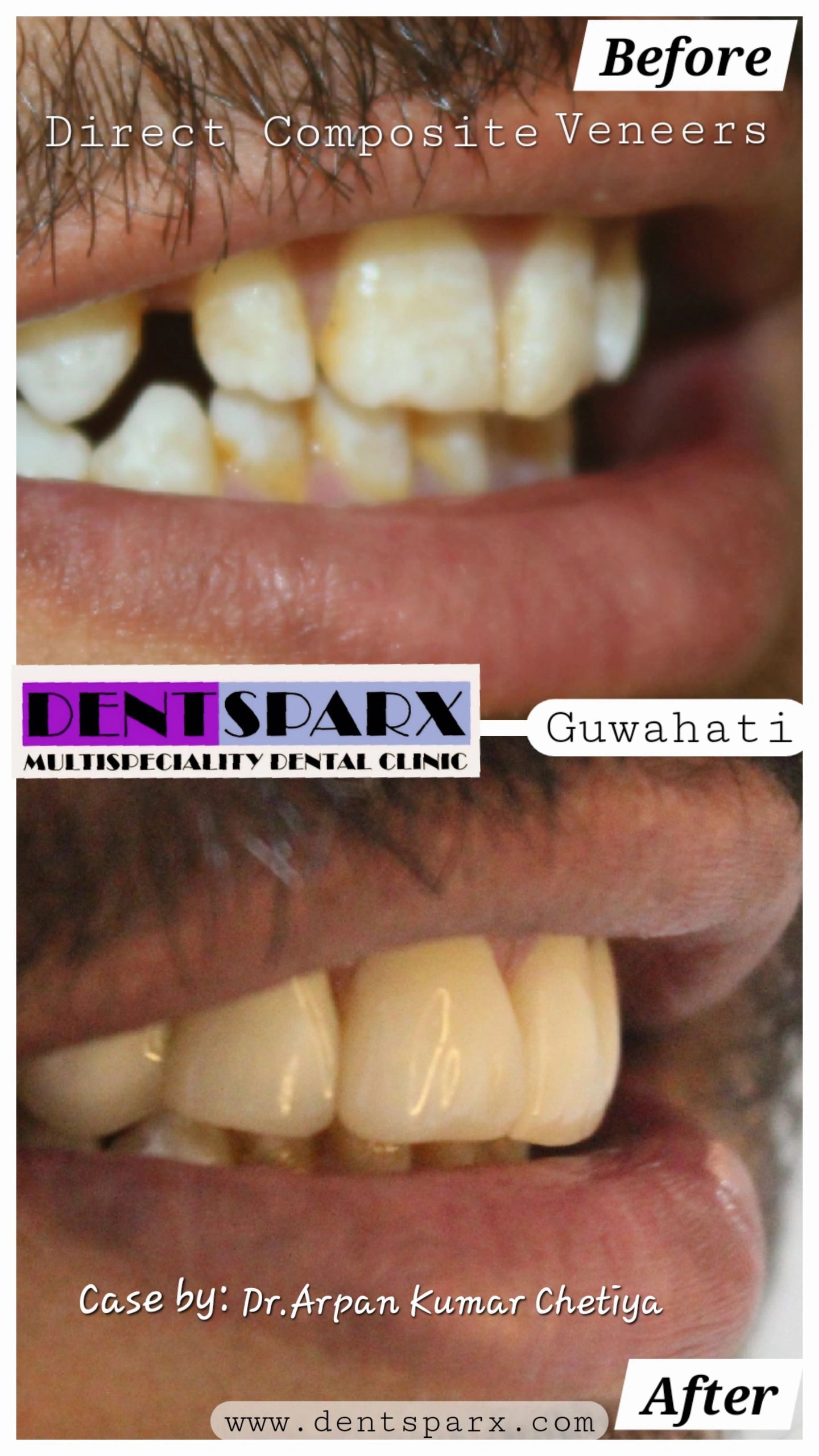 Cosmetic dentist in Guwahati.Best dentist in Guwahati