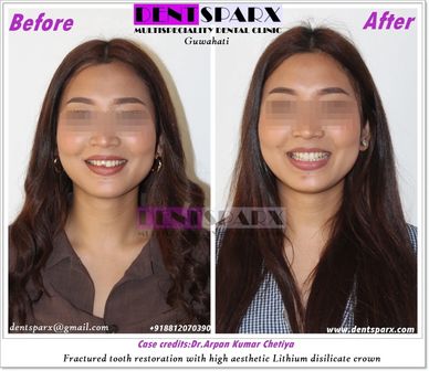 Best dentist in Guwahati Dr Arpan Kumar Chetiya .Best cosmetic dentist in Guwahati .