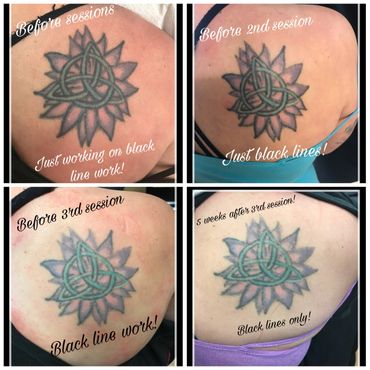 skin city ink u0026 steel tattoo tattoo removal skin city ink u0026 steel tattoo tattoo removal