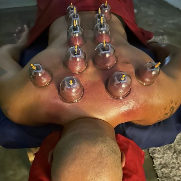 Person receiving cupping therapy on their back for muscle relief.
