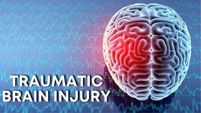 Dr. Alexander I. Jimenez, D.C. provides chiropractic and neurological rehabilitation for traumatic b