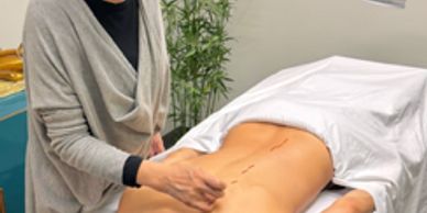Person receiving acupuncture on back.