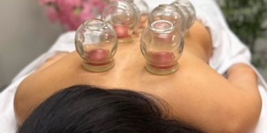 Person receiving cupping therapy on their back.