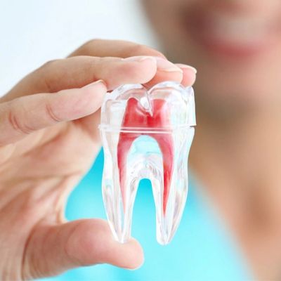 Kanal Tedavisi Diş Polikliniği Bayrampaşa İmplant