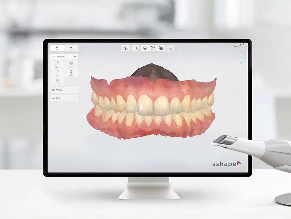  The Fully Digital Dental Lab