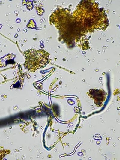 Microbe activity in soil. 