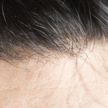 Star Wellness - Electrolysis Hair Removal, Permanent Hair Removal Star Wellness - Electrolysis Hair Removal, Permanent Hair Removal