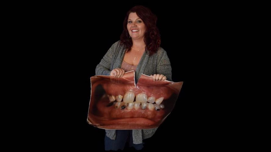 Dental Lab SIMPSON DENTAL TRENDZ, KANSAS CITY'S PREMIER DENTAL LAB