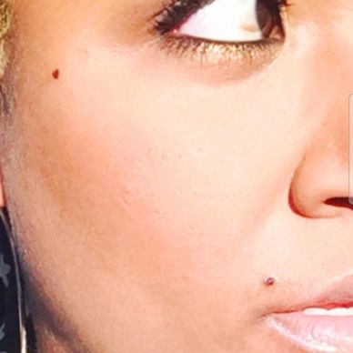 Close-up of a woman's face showing skin details and beauty marks.