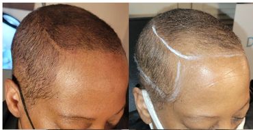 After before Hair transform