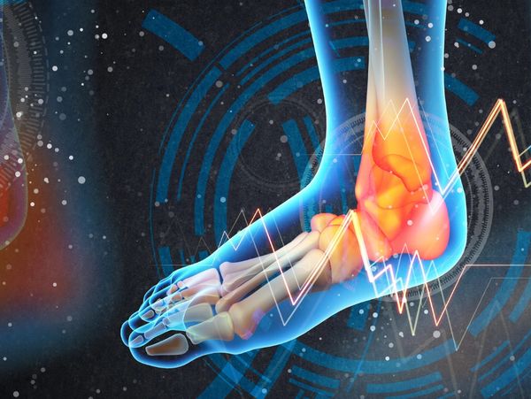 Feet 'N Beyond Hackettstown, New Jersey | Foot or Ankle Pain Laser Treatment 