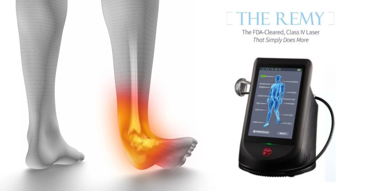 Center of Aesthetic & Minimally Invasive Foot Surgery | Remy Laser Treatment Foot or Ankle Pain