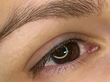 Healed results of permanent eyeliner - thin, dark lash line.