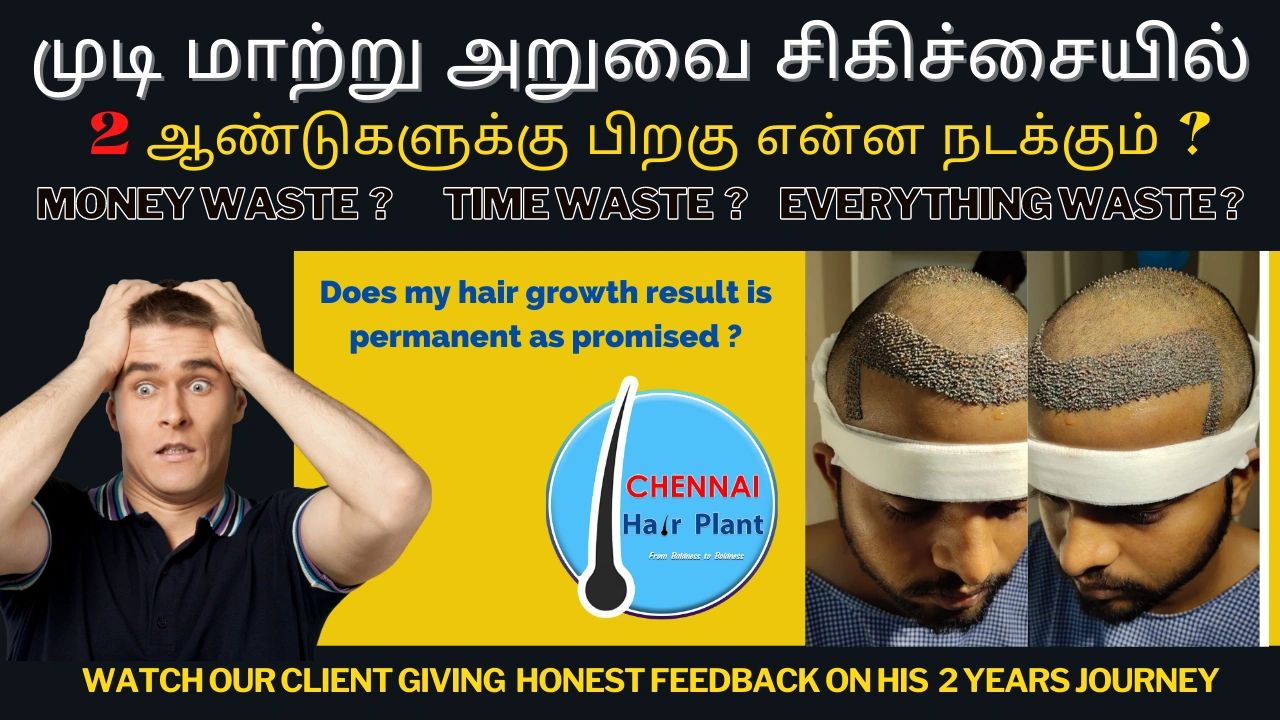 Is my Hair transplant surgery worth of money ?