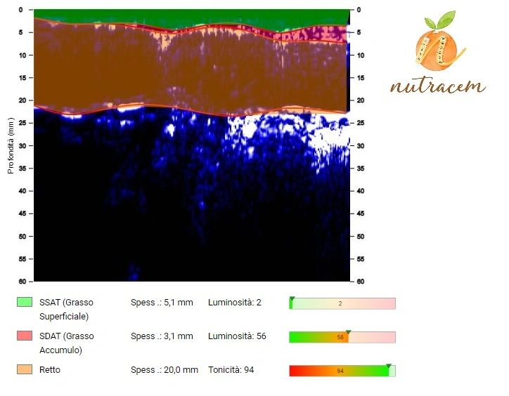 grasso addominale uomo ecografia