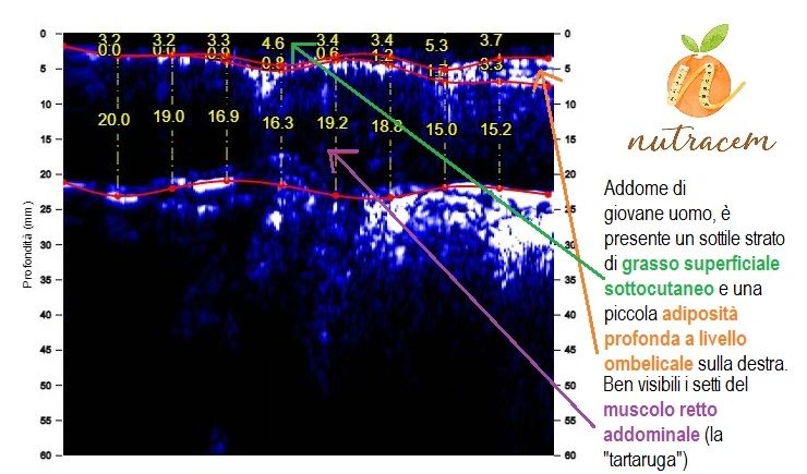 adipometria addome uomo
