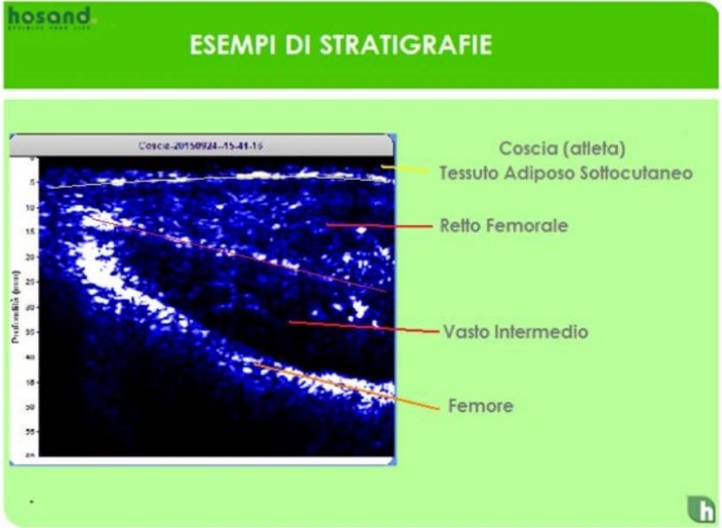 Bioimpedenziometria Analisi massa grassa , acqua totale ,muscolare