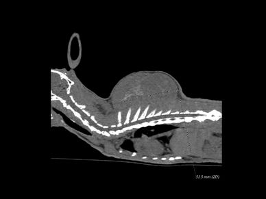 CT scan