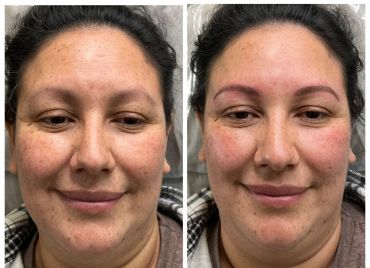 Before and after eyebrow enhancement on a woman's face.