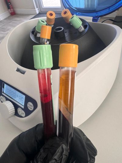 Blood samples in test tubes held by gloved hand.