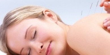 Acupuncture relaxes & heals