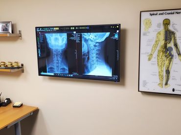 Chiropractor Stamford CT, Stamford Chiropractor, best chiropractor, Spanish speaking chiropractor