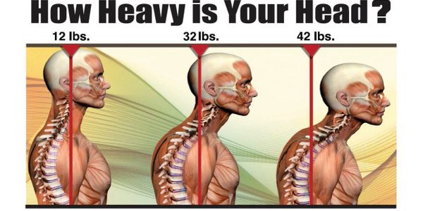 Chiropractor Stamford CT, poor posture, text neck, rolled shoulders, headaches, forward head