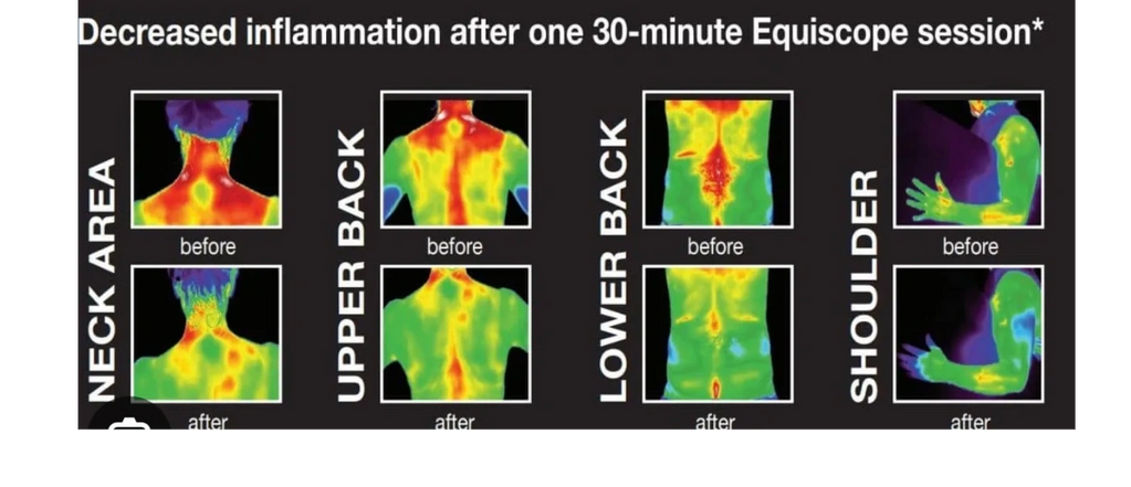 with equiscope, it scans the body and adjust output in milliseconds through instantaneous feedback