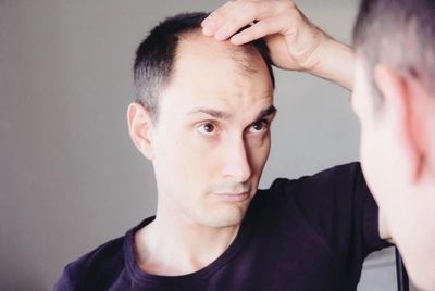 NC Hair Loss Center