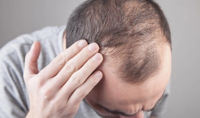 NC Hair Loss Center