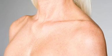 Épaule et cou d'une personne avec peau claire et cheveux blonds.