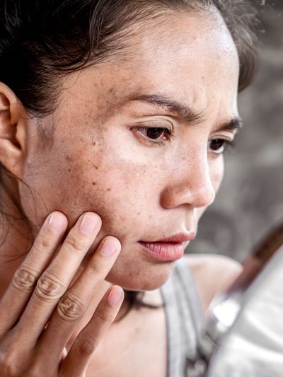 Rehausser le teint, améliorer la texture et la clarté de la peau.