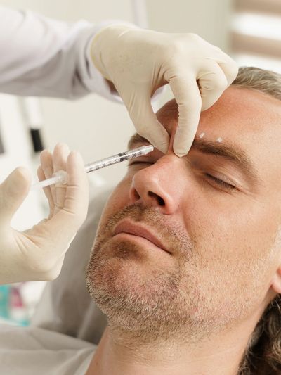 Décontracter les muscles à l'origine des sillons et des rides grâce au Botox - Dysport.