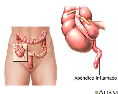 Apéndice cecal junto al intestino delgado y grueso