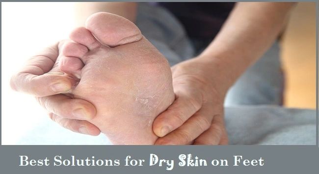 What your dry feet are telling you